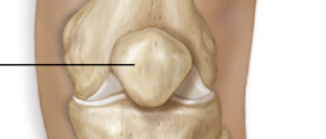<p>held in place by quadriceps tendon</p>