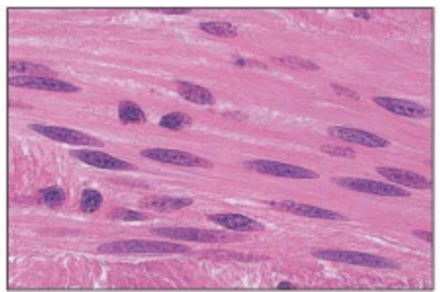 <p>Involuntary muscle found inside many internal organs of the body</p>