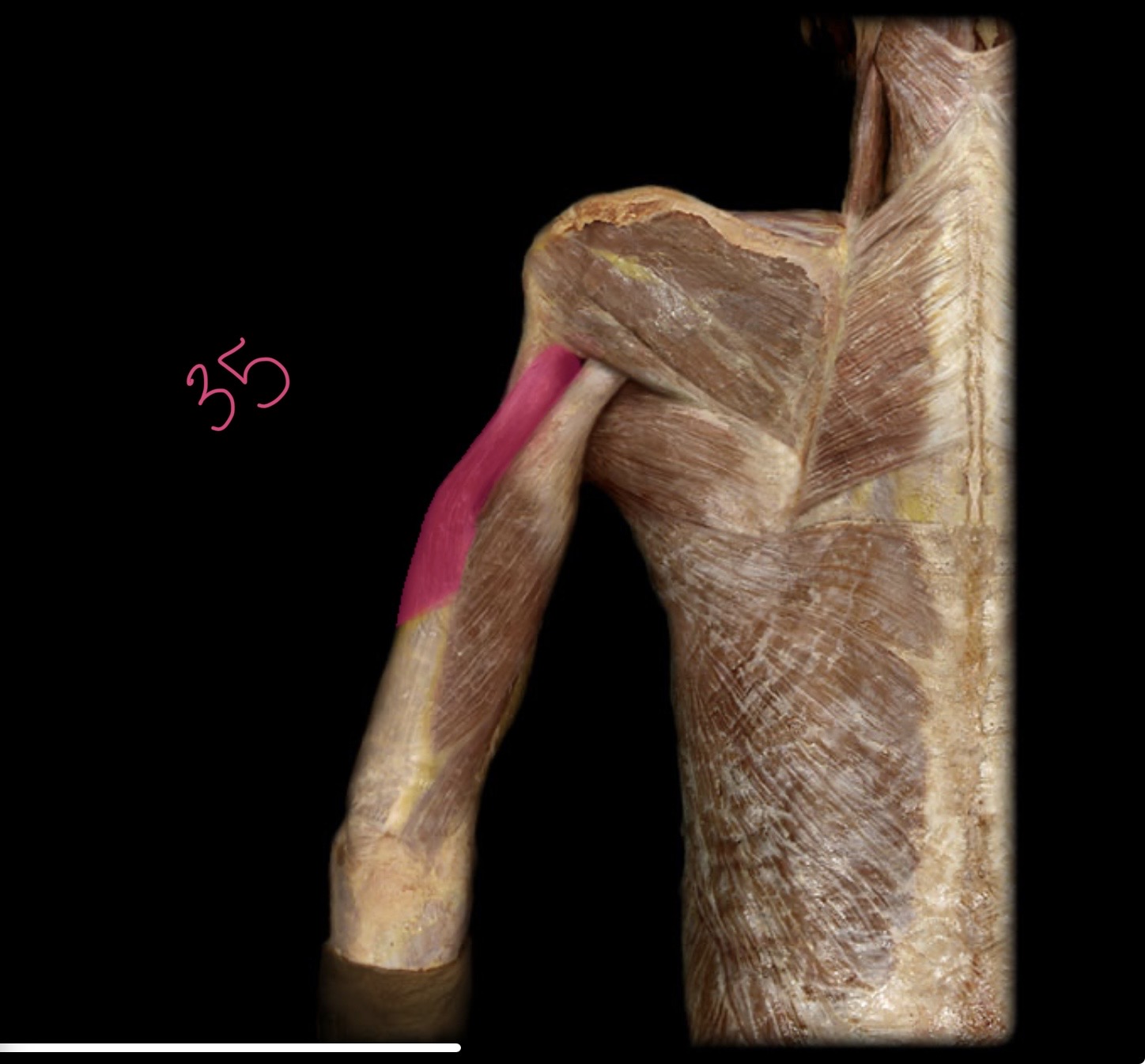 <p>Lateral head of triceps brachii</p>