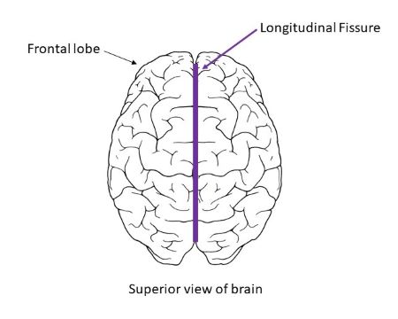 <p>longitudinal fissure</p>