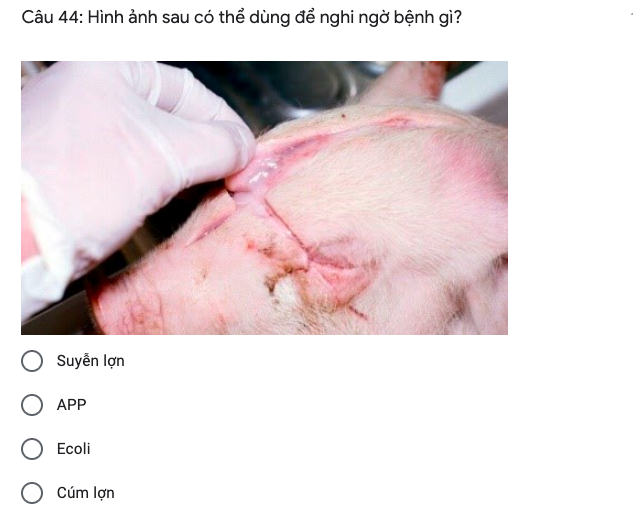 <p>Hình ảnh sau có thể dùng để nghi ngờ bệnh gì ?</p>