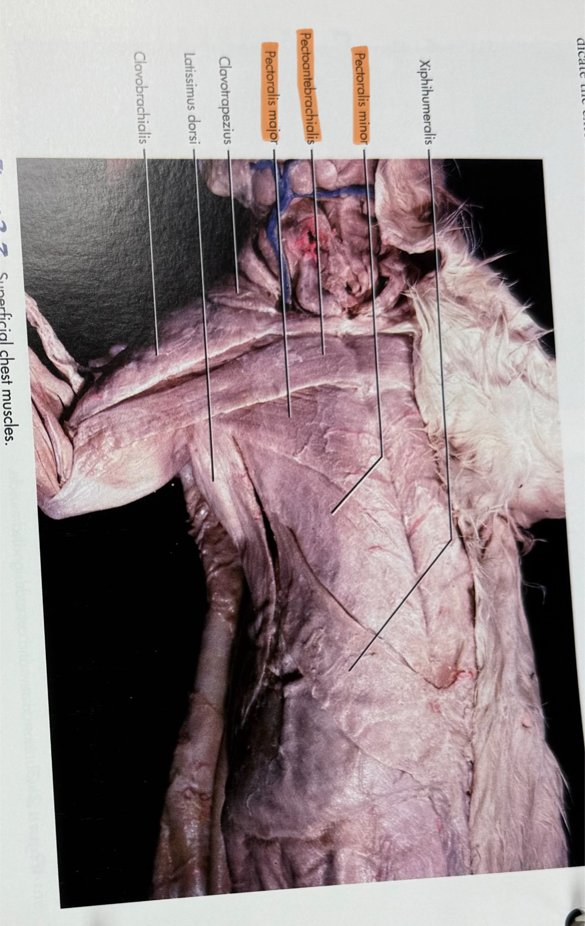 <p>Superficial pectoral action: adducts thoracic limb</p><p>Deep pectoral action: adducts and pulls limb caudally</p>