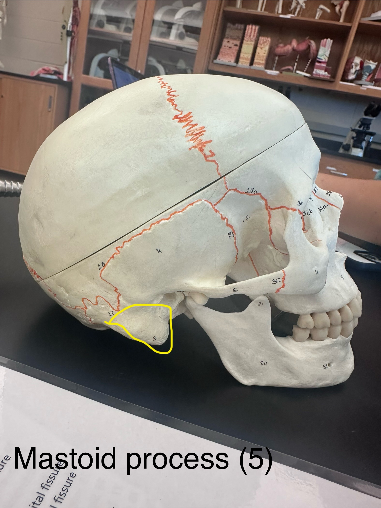 <p>Mastoid Process</p>