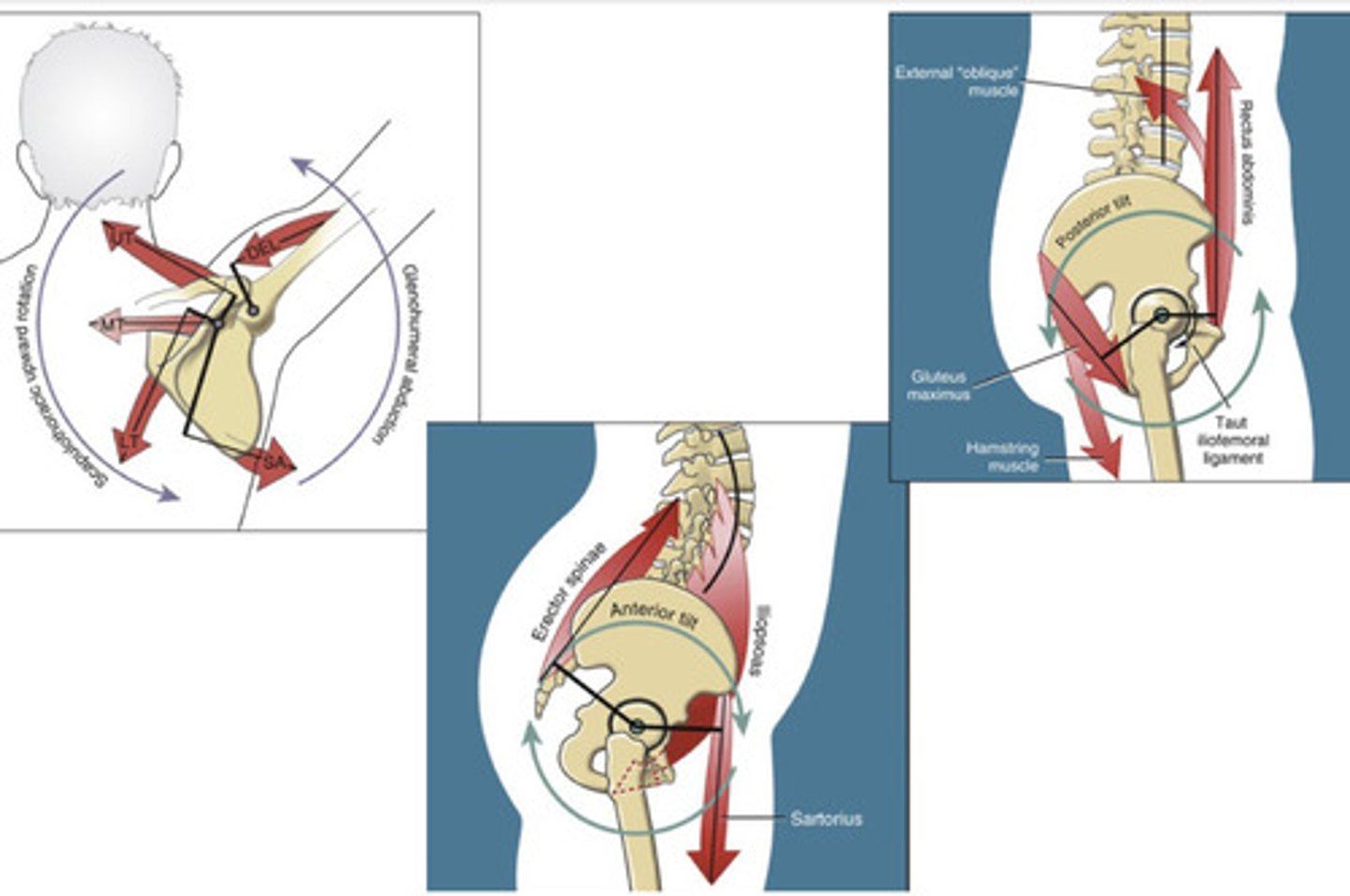 <p>2 or more muscles simultaneously produce forces in different directions that are equal in magnitude (ex. Car steering wheel or twisting open a jar - magnitude is the same but the direction is opposite)</p><p>(Ex. PPT, or APT)</p>