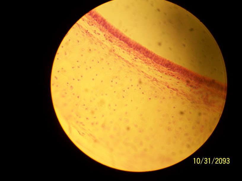 <p>Hyaline Cartilage</p>