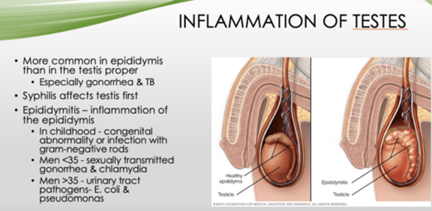 <p>epididymis (than testis proper, especially gonorrhea & TB) </p>