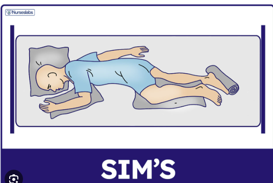 <p><span><span>a semiprone position where a patient lies on their left side with their right knee and thigh drawn up, and the left arm extended back</span></span></p>