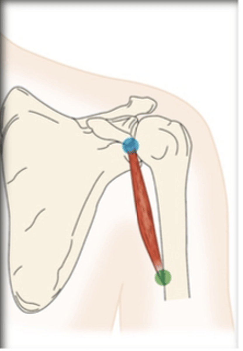 <p>What muscle is this?</p>