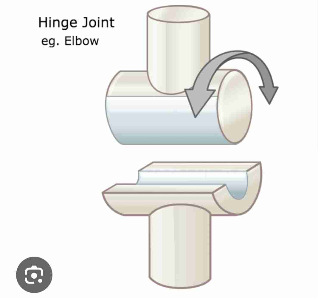 <p>What type of joint is this?</p>
