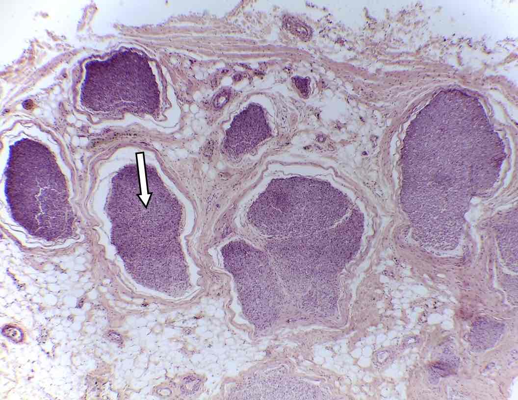 <p>Name the connective tissue layer </p>