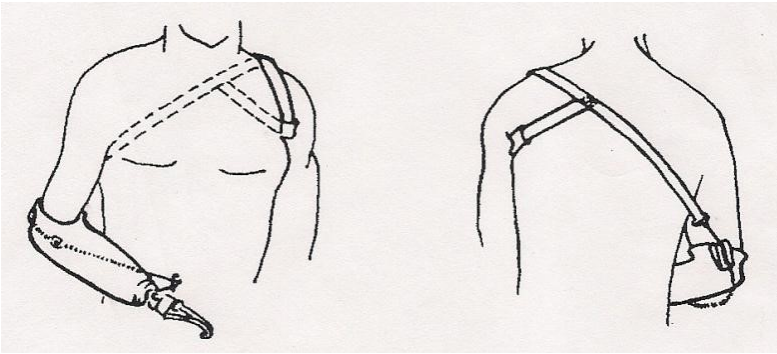 <p>Name the type of harness shown above </p>