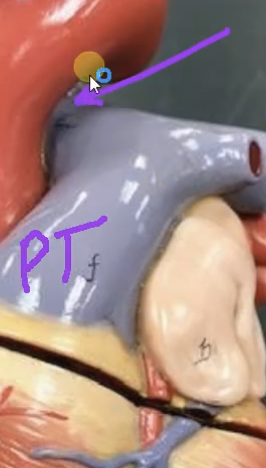 <p>What does this represnt…</p>