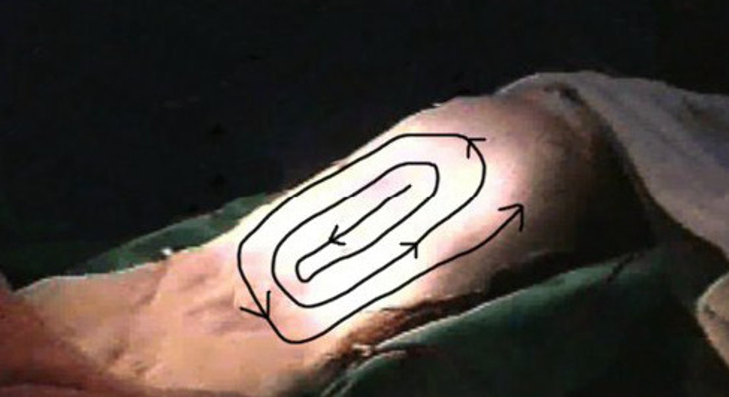 <p>start at the area of incision and move OUTWARD in circular motion***</p><p>clean → dirty</p>