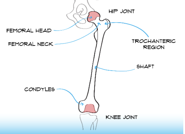 <ul><li><p>Femoral head at top of bone (proximal) near hip joint</p></li><li><p>Femoral neck</p></li><li><p>Trochanteric region</p></li><li><p>Shaft</p></li><li><p>Condyles by knee joint</p></li></ul>