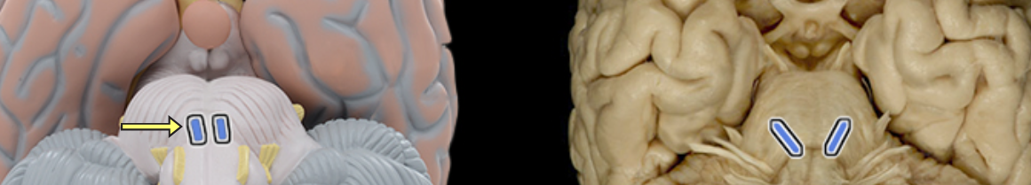 <p>Location:</p><ul><li><p>Middle cranial fossa</p></li><li><p>Orbit</p></li></ul><p>Composition:</p><ul><li><p>Motor</p></li></ul><p>Motor:</p><ul><li><p>Lateral rectus muscle</p></li></ul><p>CNS connection:</p><ul><li><p>Pons (abducens nucleus)</p></li></ul><p>Cranial foramina:</p><ul><li><p>Superior orbital fissure</p></li></ul><p>Comment:</p><ul><li><p>Abducens nerve also known as abducent nerve or CN VI</p></li></ul><p></p>