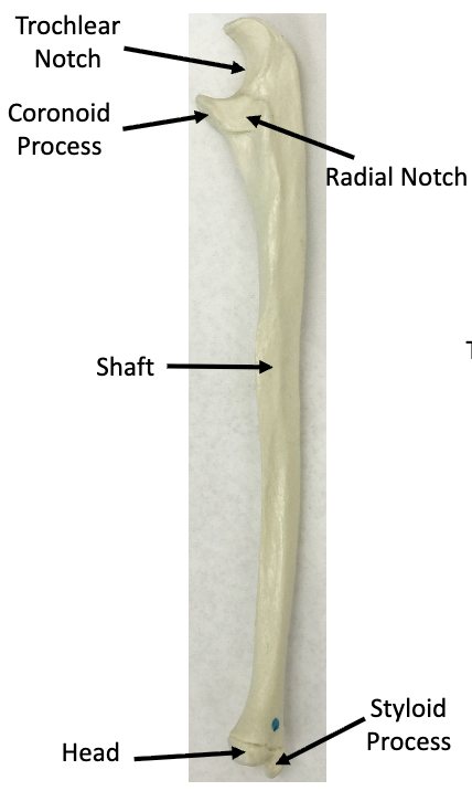 <p>What bone is this?</p>