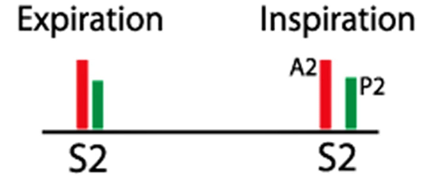 <p>one sound during expiration</p><p>splitting sound during inspiration</p>