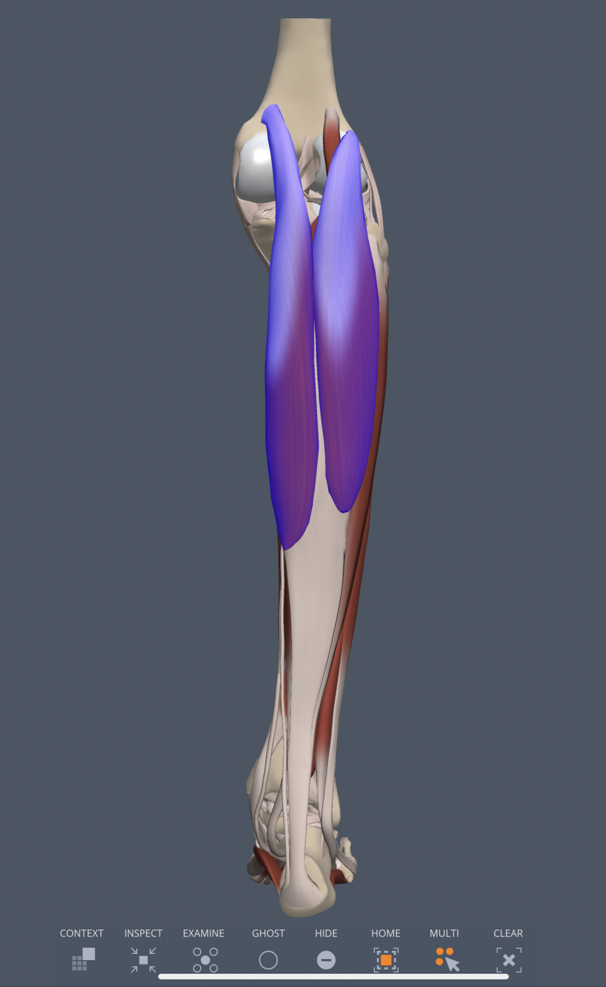 gastrocnemius (superficial calf, posterior leg) insertion
