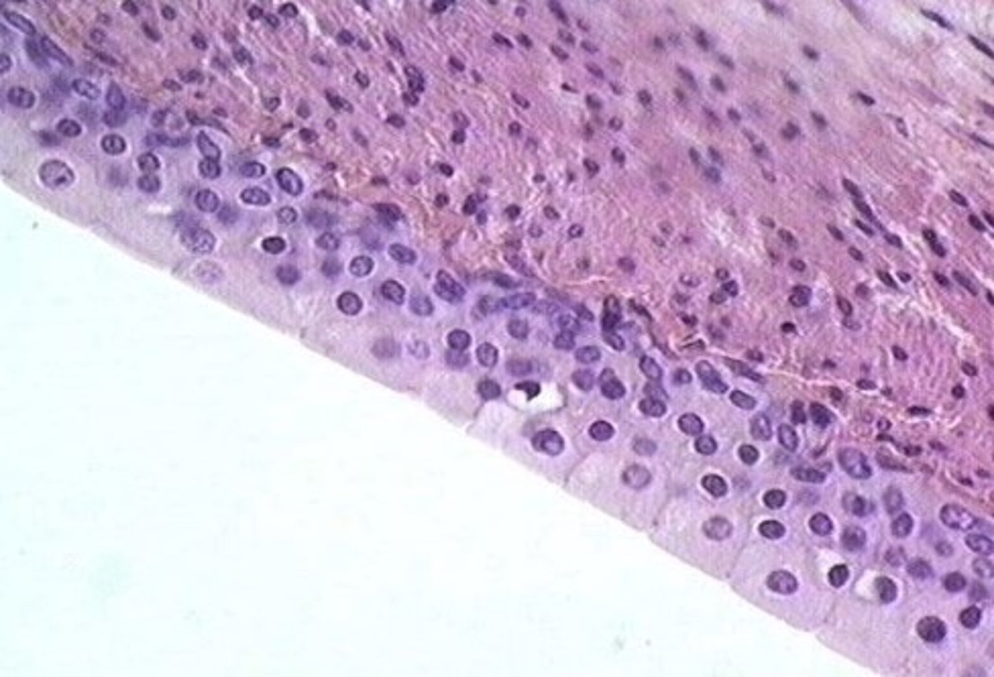 <p>renal pelvis</p>