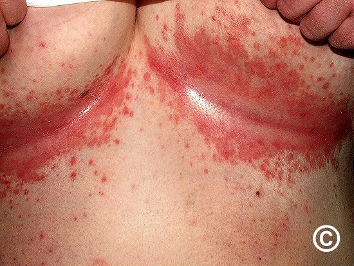 <p>What is this physical exam </p>