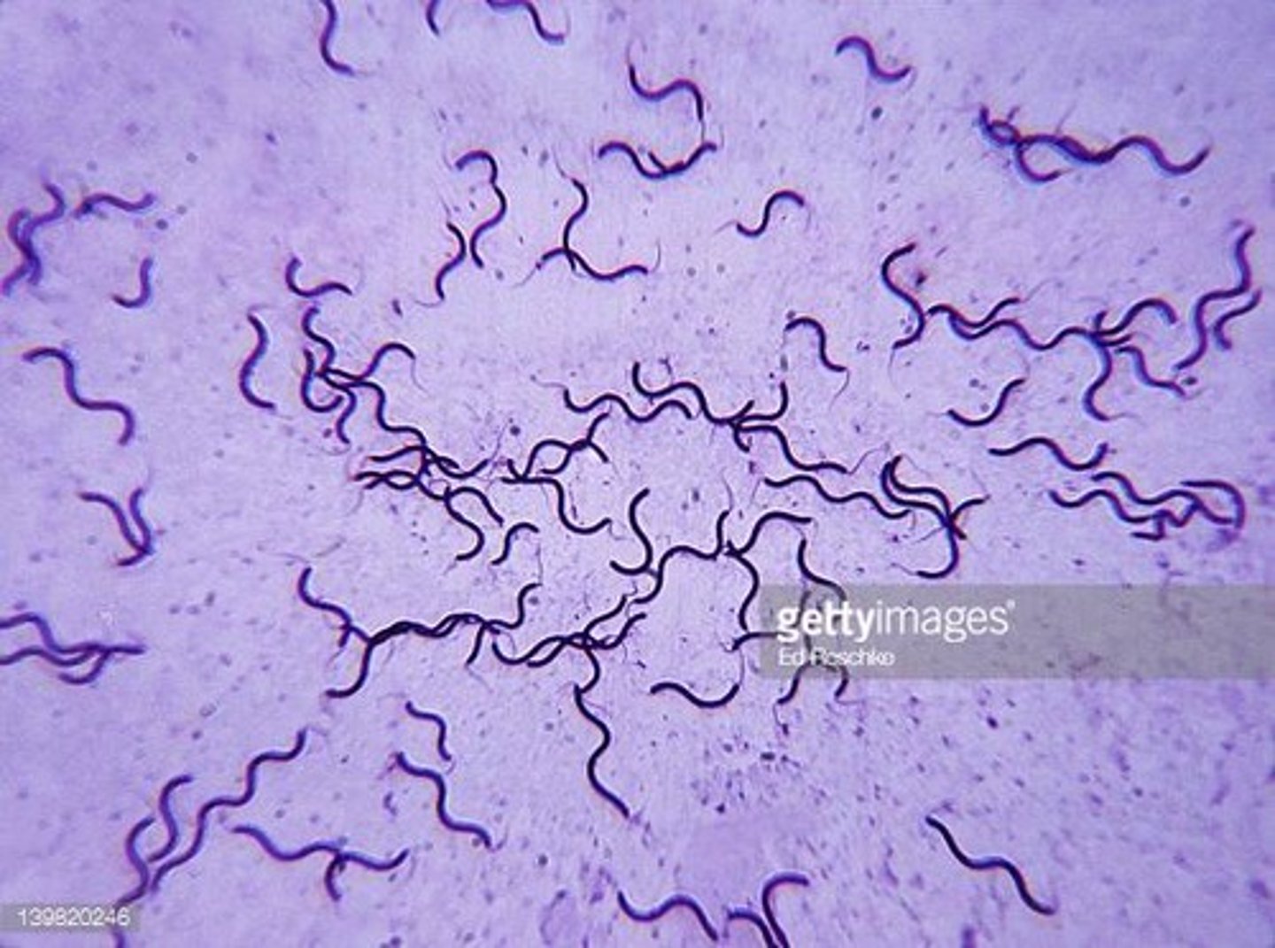 <p>The following image is an example of ________ shaped bacteria.<br>a. spiral<br>b. coccus<br>c. baccilus<br>d. vibrio</p>