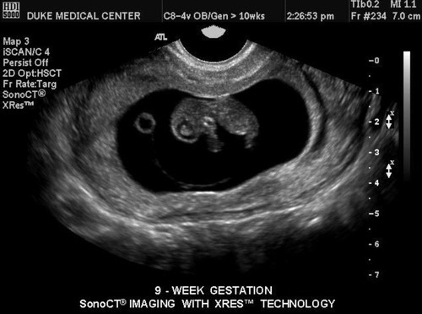 <p>All organs and main features present</p><p>Straight neck</p><p>Distinct cerebral hemispheres</p>