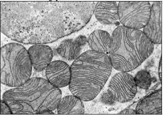 What type of cell is most likely shown below?

a. red blood cell 

b. muscle cell 

c. plant mesophyll cell 

d. nerve cell 

e. macrophage