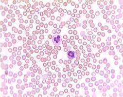 <p>What tissue is this</p>