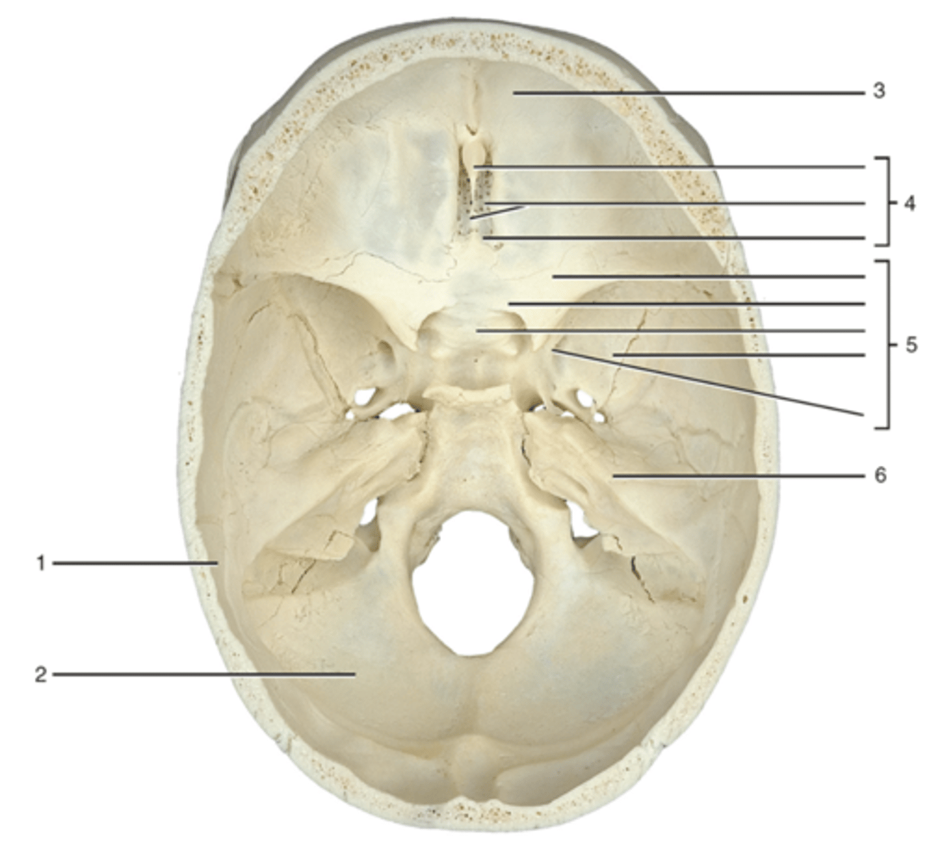<p>sphenoid bone</p>