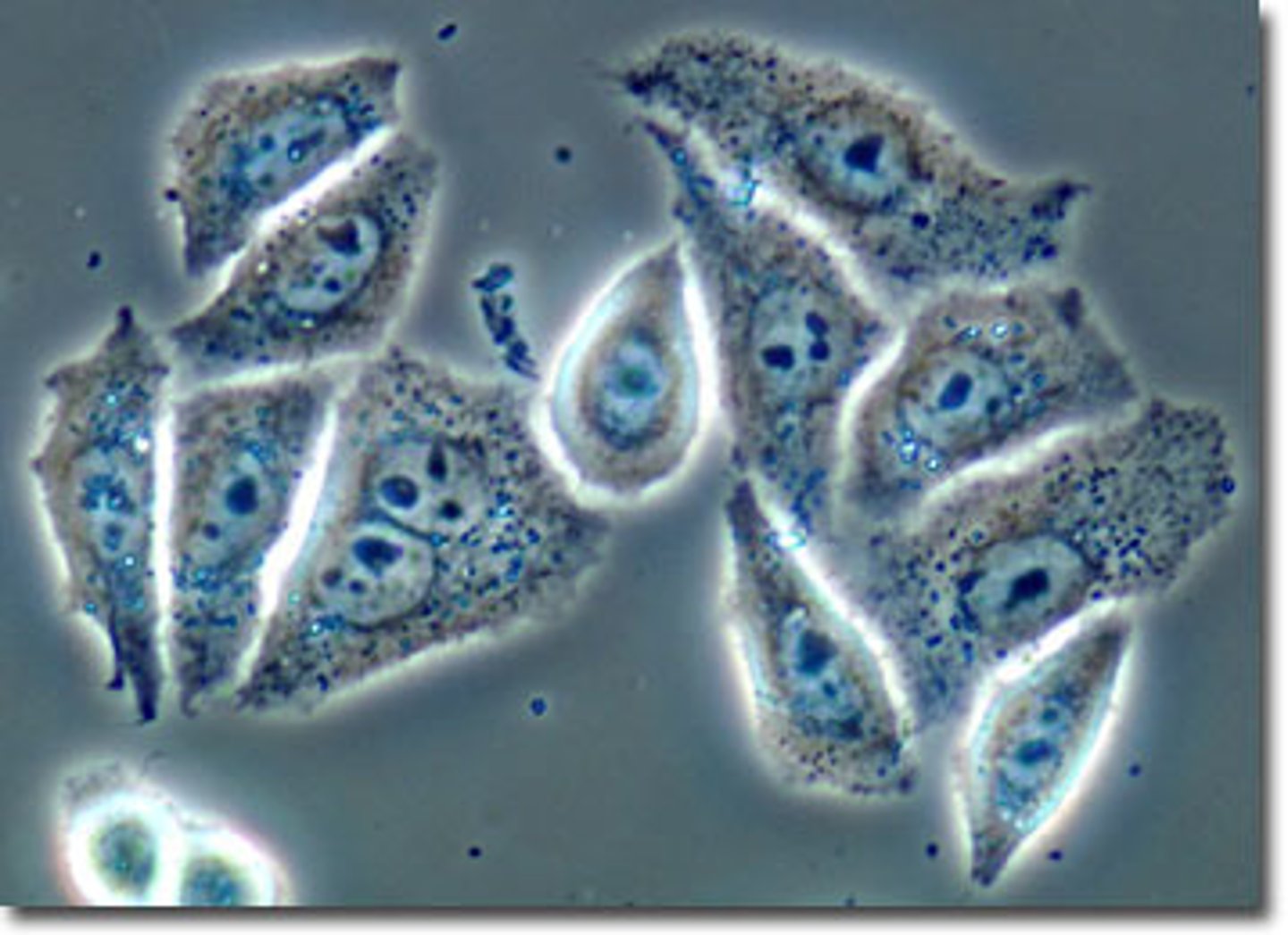 <p>light microscope that uses refraction and interference to enhance contrast; useful in examining living, unstained cells (endospores and organelles)</p>