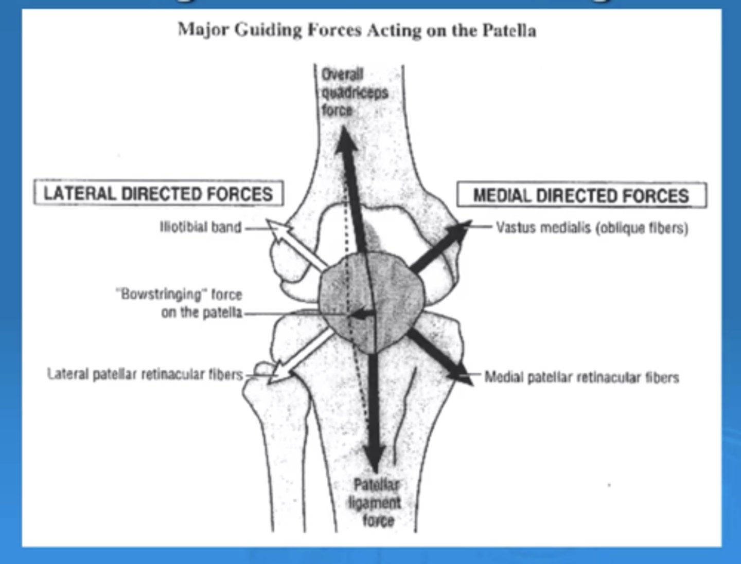 <p>More lateral </p><p>This is why people dislocate more lateral, because we have more forces pulling laterally than medially. </p><p>Clinically, you want to have a more equal pull to prevent dislocatiom.</p><p>If you have a larger Q angle, you can have more lateral pull</p>