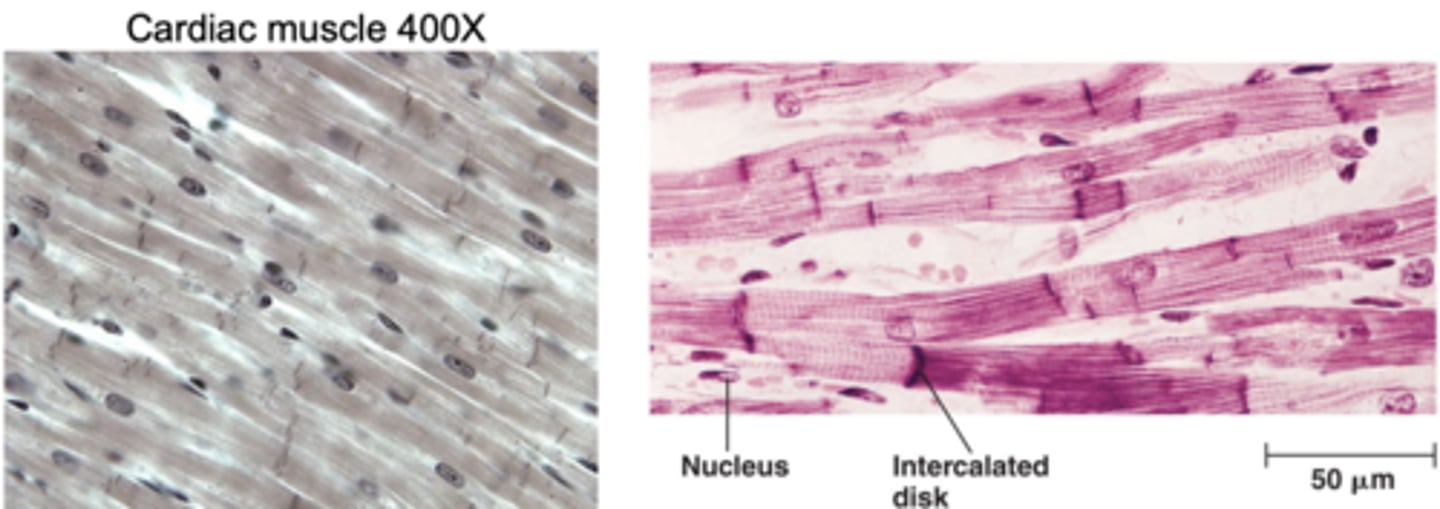 <p>• Straited, but less obvious than in skeletal muscle</p><p>• Branched cells, each with a single nucleus</p><p>• Numerous connections between cells</p><p>• Intercalated discs: connections between two cardiac muscle cells to allow for rapid communication between cells</p>
