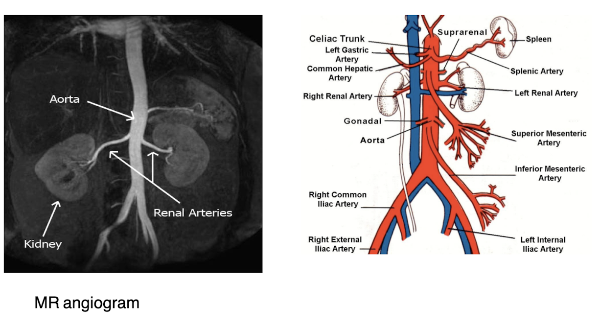 <p>The kidneys have a highly vascular structure, with renal arteries supplying blood and a rich network of capillaries, ensuring adequate perfusion for filtration and waste removal. </p>