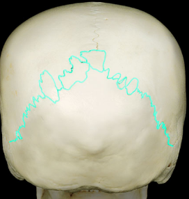 <p>connects the occipital bone to the parietal bones (towards the &quot;back&quot;/&quot;base&quot; of the skull-- triangle shaped)</p>