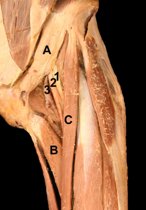 <p>B</p>