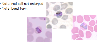 <p>What is the genus, species, and stage of this parasite?</p>