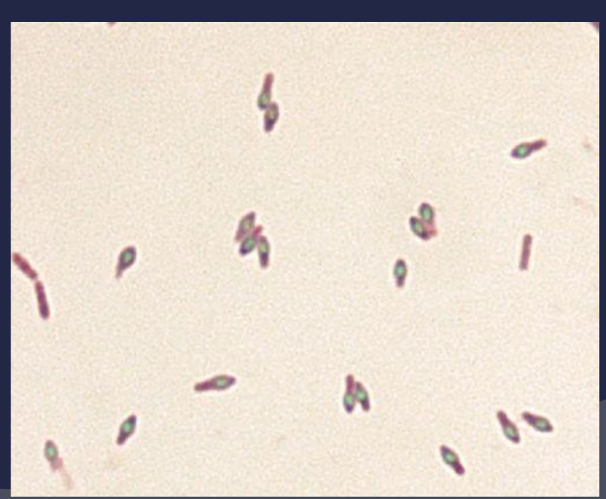 <p><br><span style="font-family: Arial, sans-serif">Clostridium botulinum</span></p>