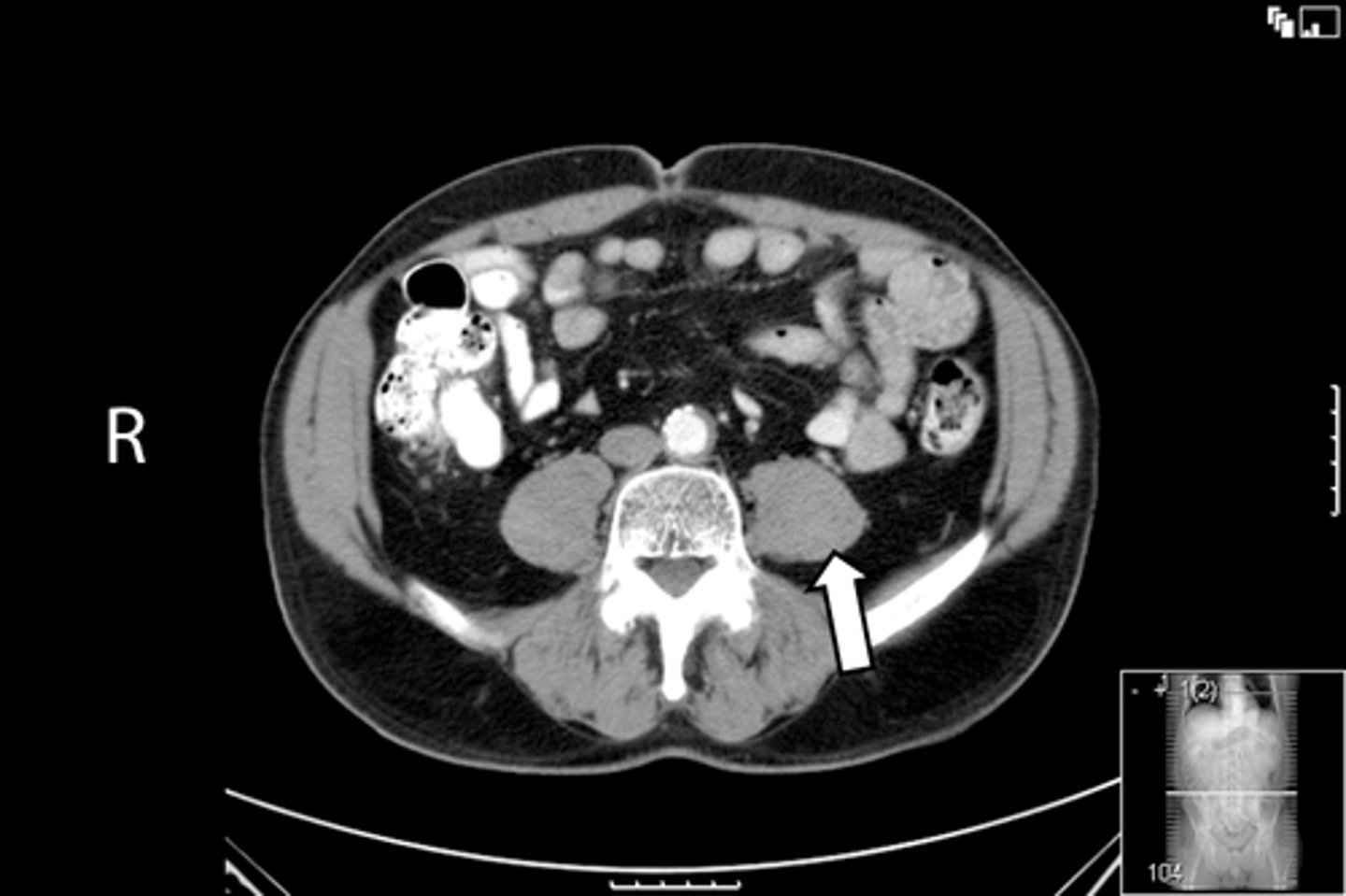 <p>What is indicated in the image?</p>