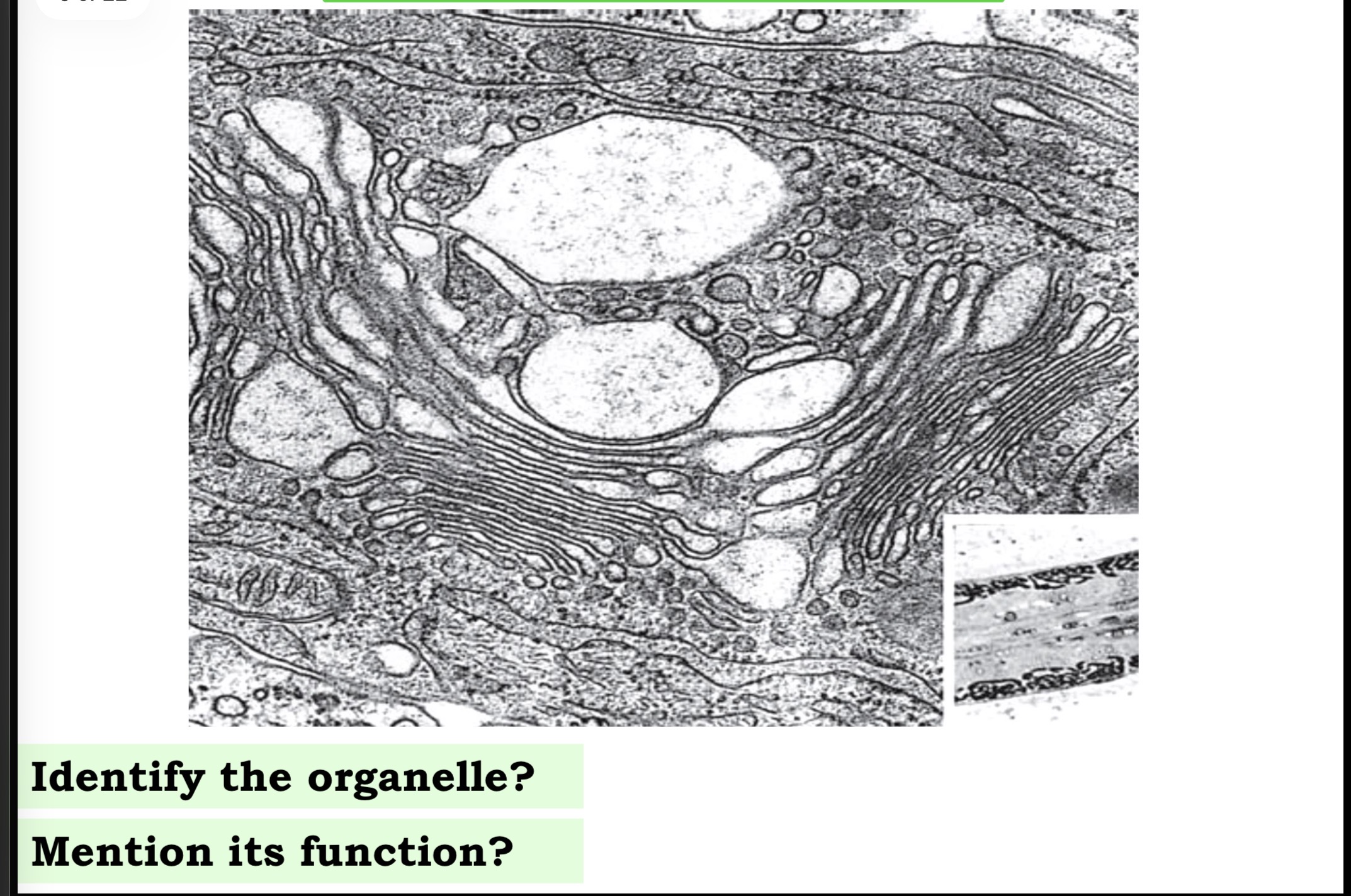 <p>Answer the questions in these following pictures</p>