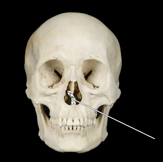 <p>Name this bone.</p><p>(Skull, anterior view).</p>