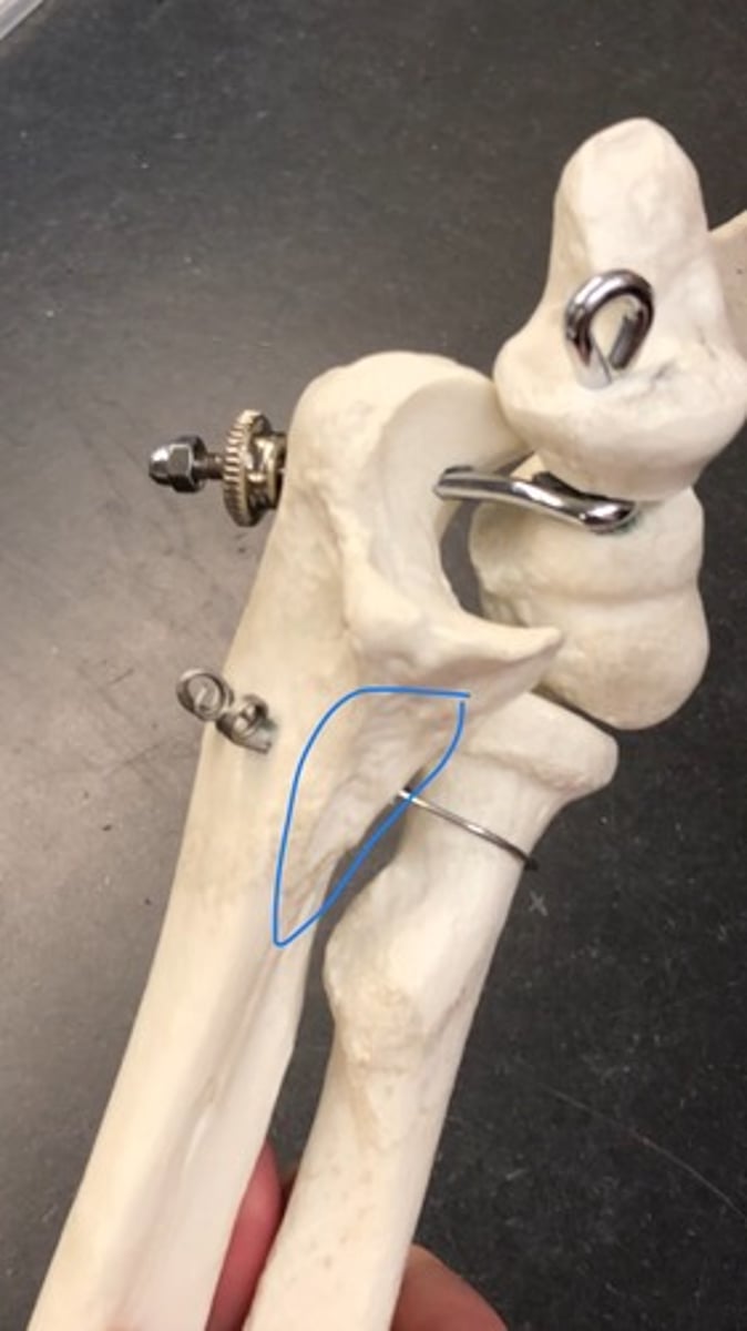 <p>rough patches under coronoid process</p>
