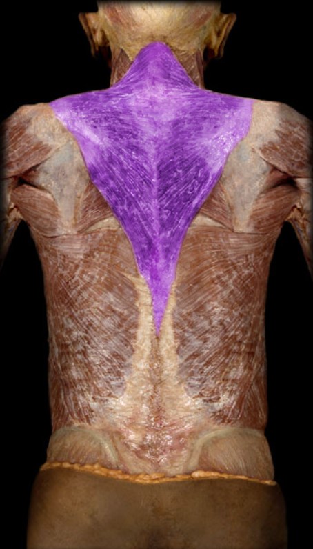 <p>Name the muscle highlighted (one word - all lowercase)</p>