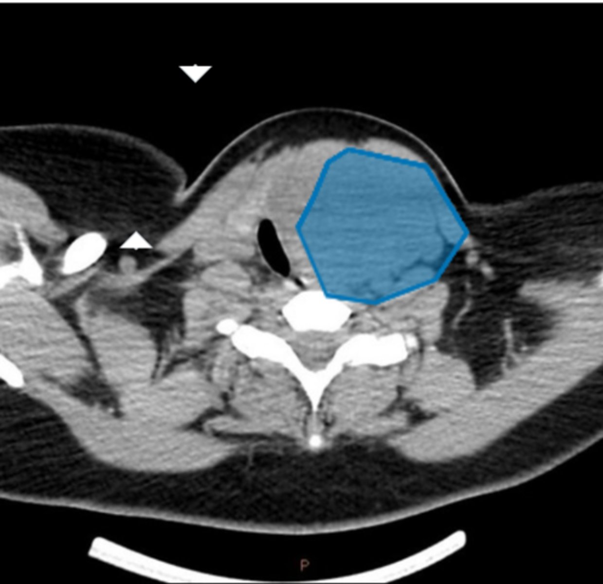 <p>Label pathology in image below</p>