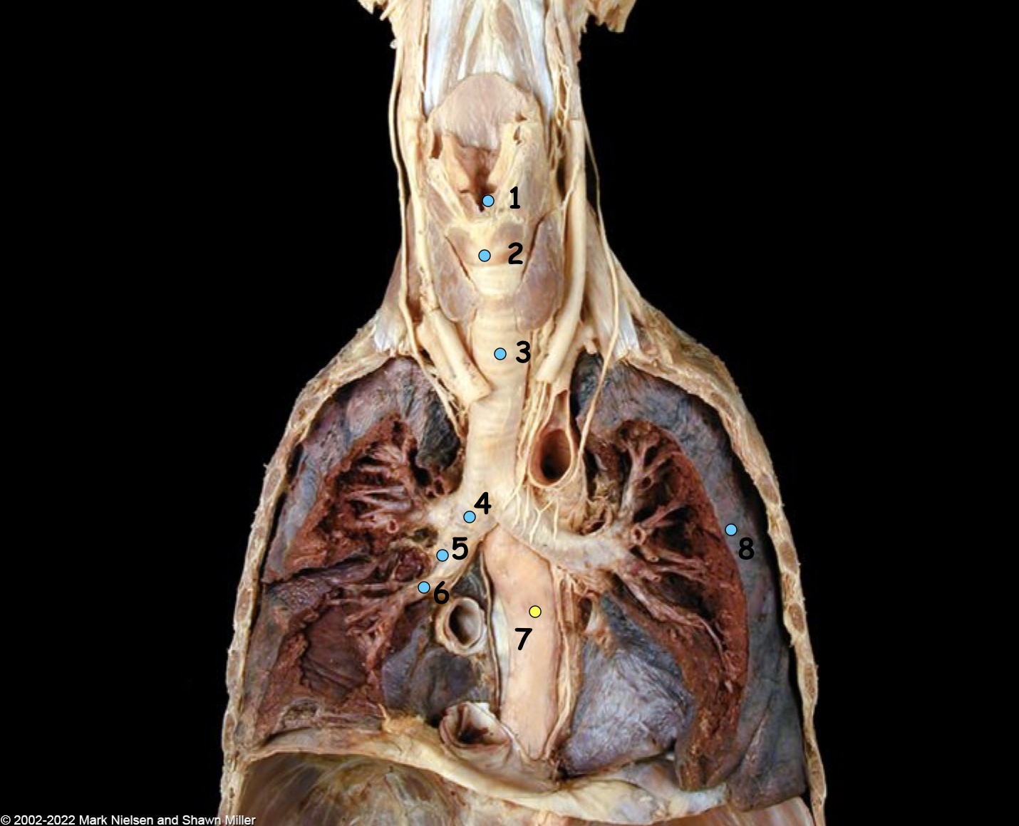 <p>What is number 1</p>