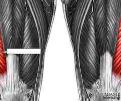 <p>Extends leg at the knee; part of the quadriceps group</p>
