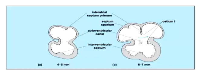 <ol><li><p>Starts with just 2 chambers</p></li><li><p>Subdivision of the primitive atrium and ventricle -beginning marked by appearance of interatrial septum primum and interventricular septum</p></li><li><p>Single atrioventricular canal between the primitive atrium and ventricle also begins to divide- will eventually form separated right and left atrioventricular ostia</p></li></ol><p></p><p>Fully functional 4-chambered heart does not form until birth. </p><p></p>