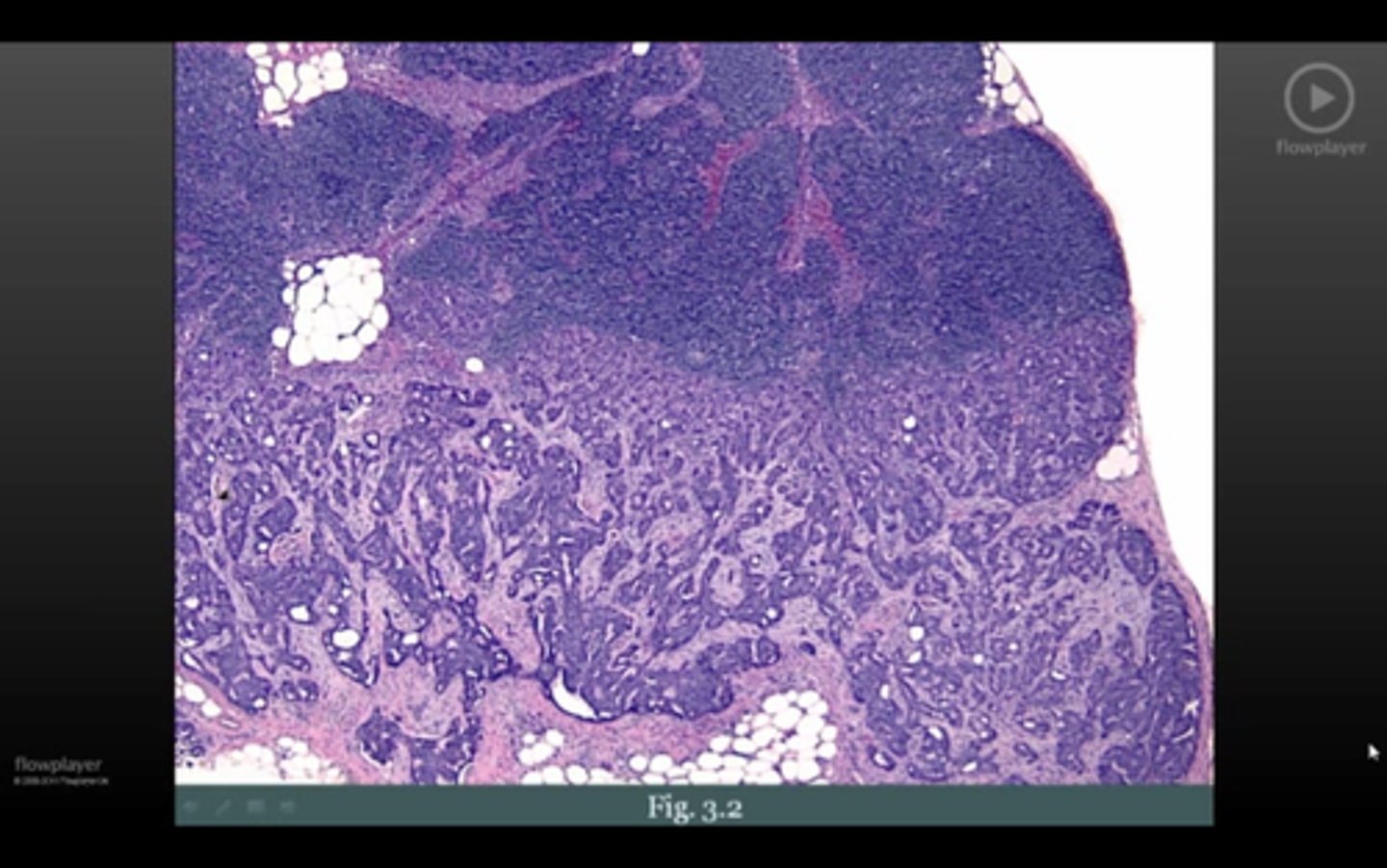 <p>BRCA in what tissue</p>