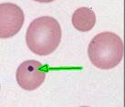 <p>Small, dark purple, round bodies located in the periphery of the cell; usually occur singly </p><p>*All Inclusion are in Red  </p>