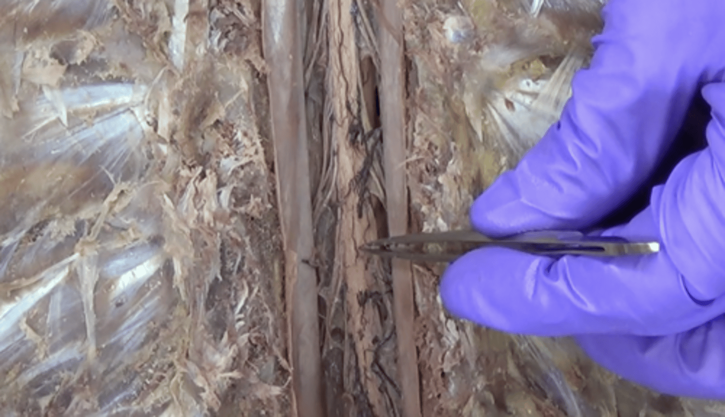 <p>a space in the meninges beneath the arachnoid membrane and above the pia mater that contains the cerebrospinal fluid</p>