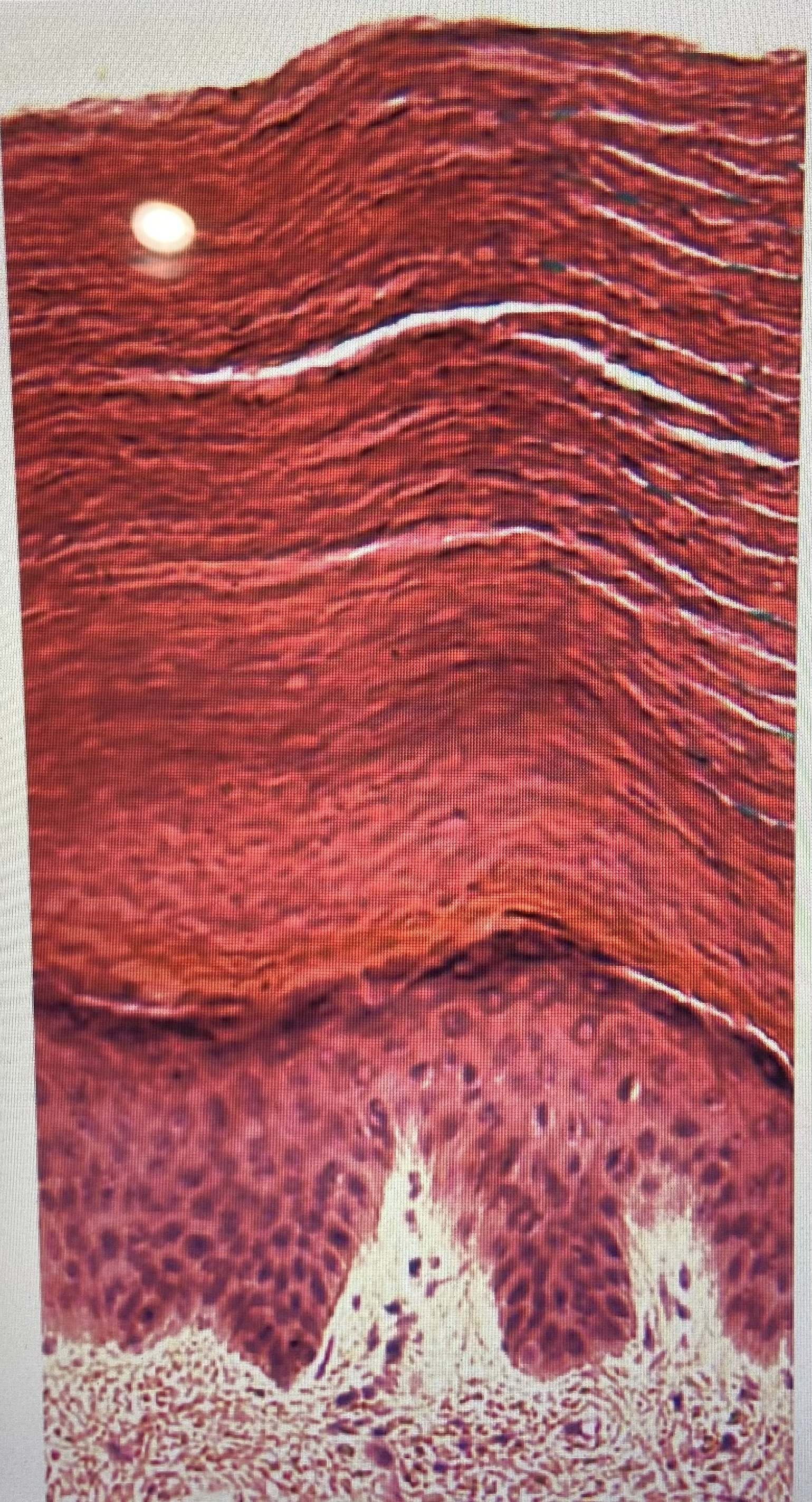 <p>how many epithelial layers are present in this image </p>